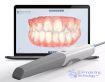 2-Intraoral Scanners Combining 3D Printing
